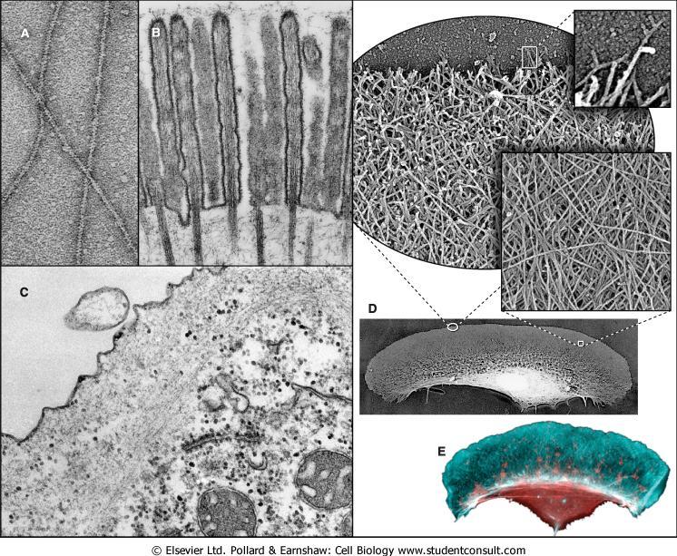 FILAMENTOS DE ACTINA A: filamentos de actina isolados; B: microvilosidades com feixes de actinas C: Córtex celular de Acanthamoeba; D: Queratinócito de