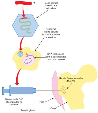 Introdução de genes normais em células de medula óssea vermelha.