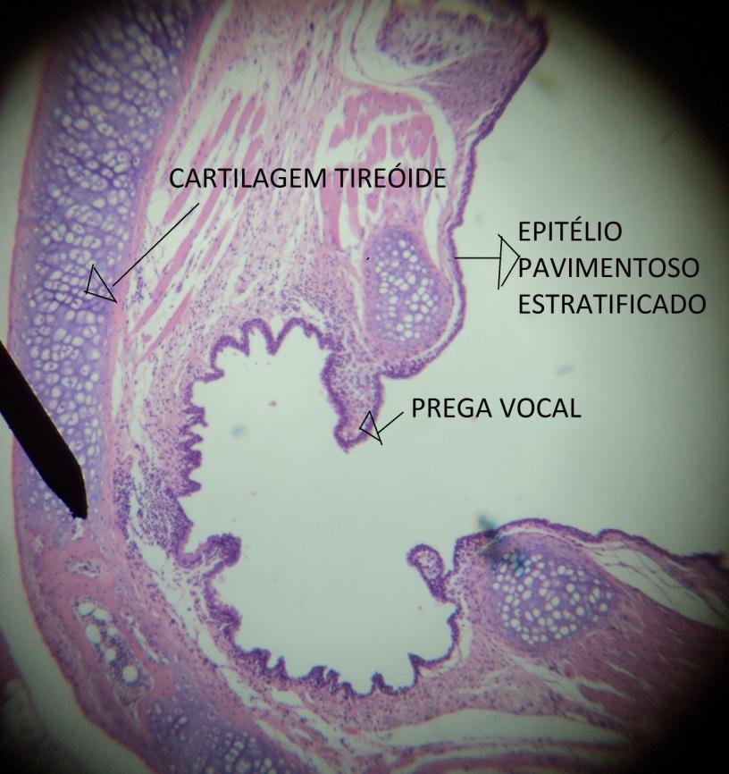 Pregas Histologia vocais: da camadas laringe Espaço de