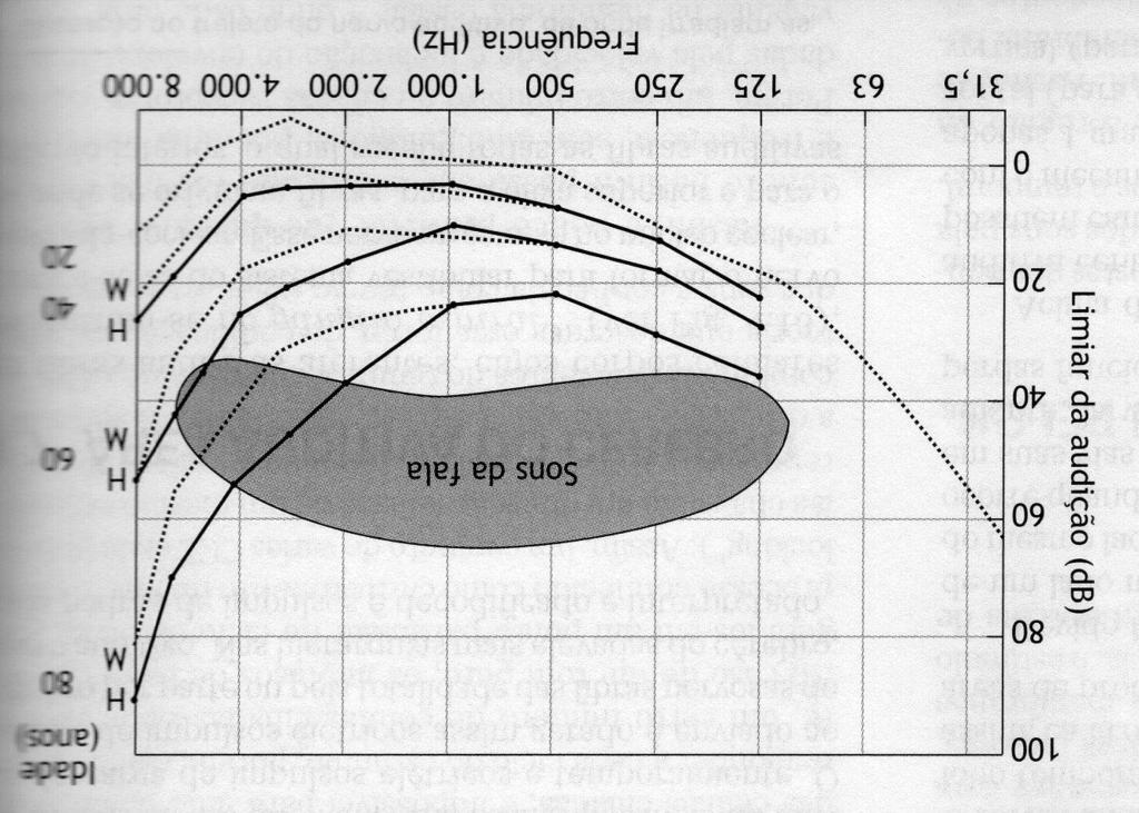 PERDA AUDITIVA NEUROSSENSORIAL Deslocamentos do limiar de audição por