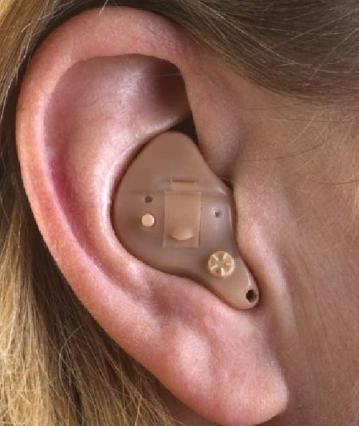 Intra Auricular (ITE) In-the-ear Os ITEs são integralmente contidos em uma concha ou invólucro em acrílico que se adapta ao ouvido externo.