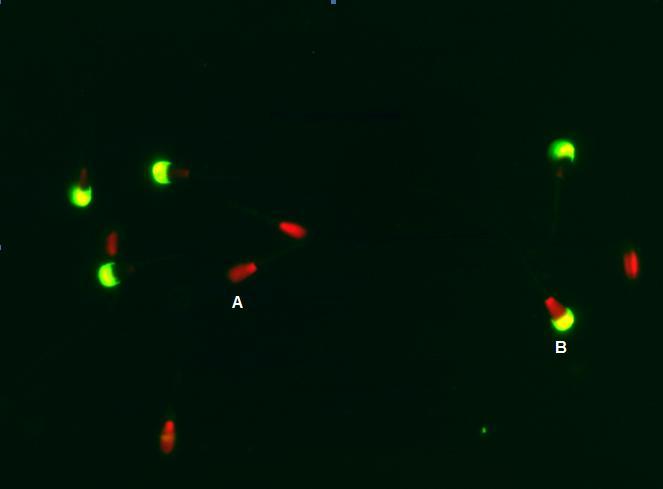 22 Para integridade da membrana acrossomal foi utilizada a sonda fluorescente isotiocianato de fluoresceína conjugado com a aglutinina do amendoim (Arachis hypogea) (FITC-PNA) e iodeto de propídeo