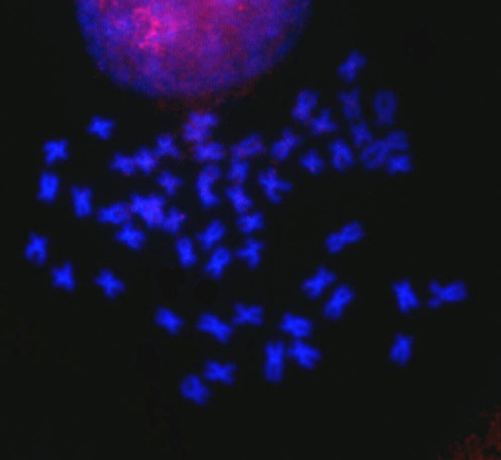 Figura 2. Hibridação in situ fluorescente com a sonda PM1B em preparação cromossômica de um exemplar de Prochilodus lineatus não portador de cromossomos B.