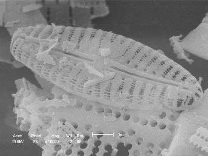 Microscopia Eletrônica de Varredura Figura 4 Difração de Raios-X da amostra DC.