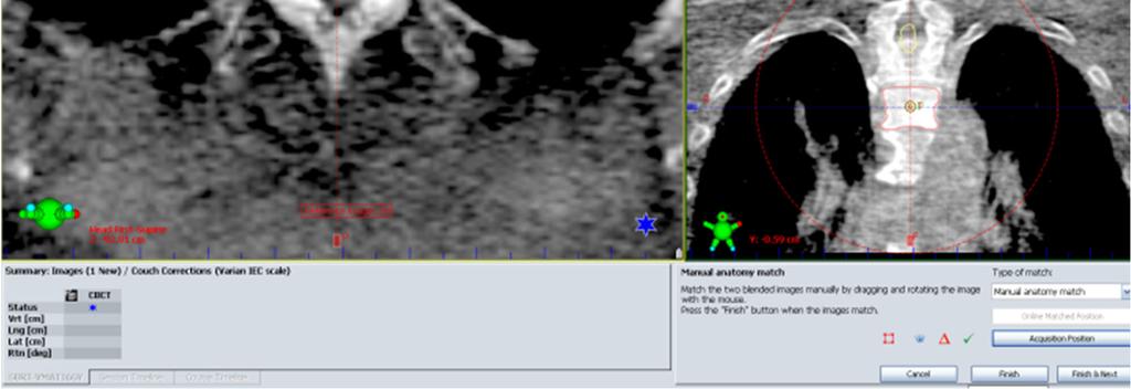 CBCT pós fusão