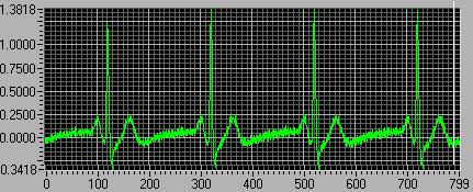 deles (com auxilio de um programa computacional, e.g. MatLab.