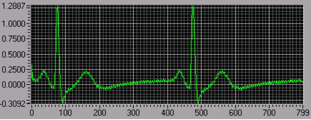 Sinal de ECG original Sistema de aquisição de dados Conceitos gerais Sistema de aquisição de dados é qualquer arranjo que possibilite transformar