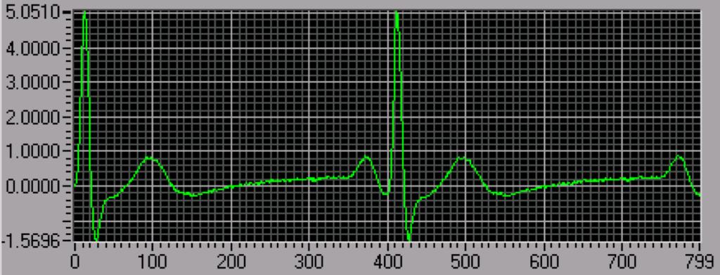 entre outros. Sinal após filtro digital ra ordem (entrada = sinal 0% ruído 60Hz) Sinal após filtro digital 2da ordem (entrada = sinal 0% ruído 60Hz).