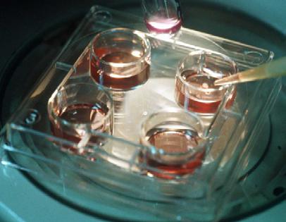 Geralmente em torno do terceiro dia após a obtenção e fertilização dos gametas, o Laboratório de FIV já estipulou com o medico assistente a melhor data para transferência dos Embriões.