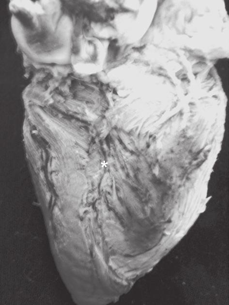 A artéria coronária direita, situada no sulco coronário, esteve presente em todos os corações, e era única (100,0%).