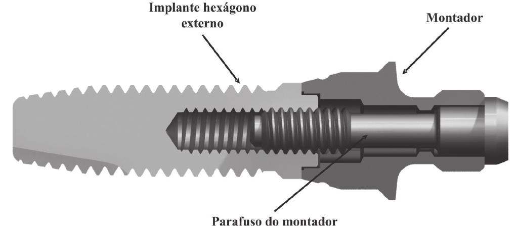 Implantes com conexão cônica interna 1.