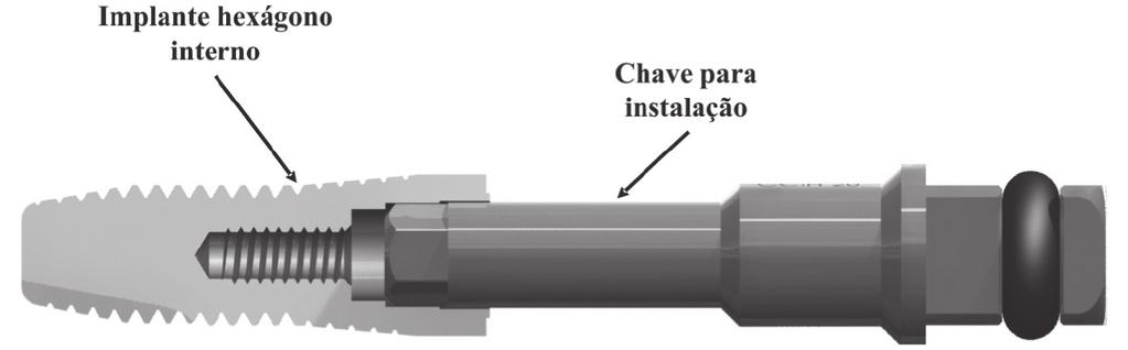 Michel Aislan Dantas Soares / Ricardo Luiz Ciuccio Athos Jacomini Filho / Nelis Evangelista Luiz / Ariel Lenharo Implante hexágono interno Chave para instalação Figura 2 Implante com conexão hexágono