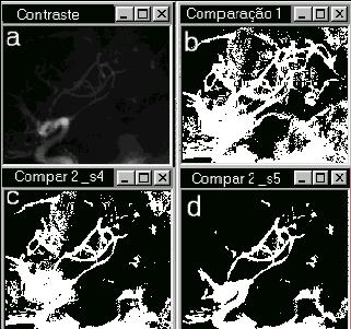 Figura 4 Imagens resultantes por comparação 1 a. imagem contraste b. imagem res. por comparação 1 c. imagem res. por comp. 1 após sup.