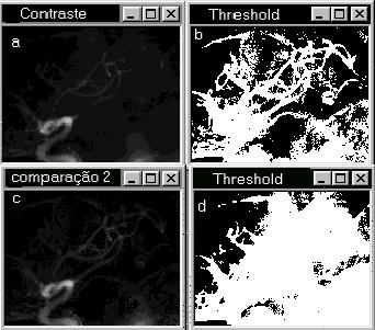 Figura 5 Imagem realçada por "threshold" A imagem obtida por threshold" na figura 5.