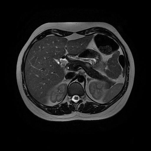 17 Fonte: Serviço de Radiologia do HC-FMUSP.