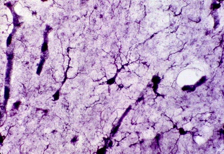 A micróglia, aqui demonstrada pela impregnação argêntica de Rio Hortega, mostra prolongamentos que saem dos