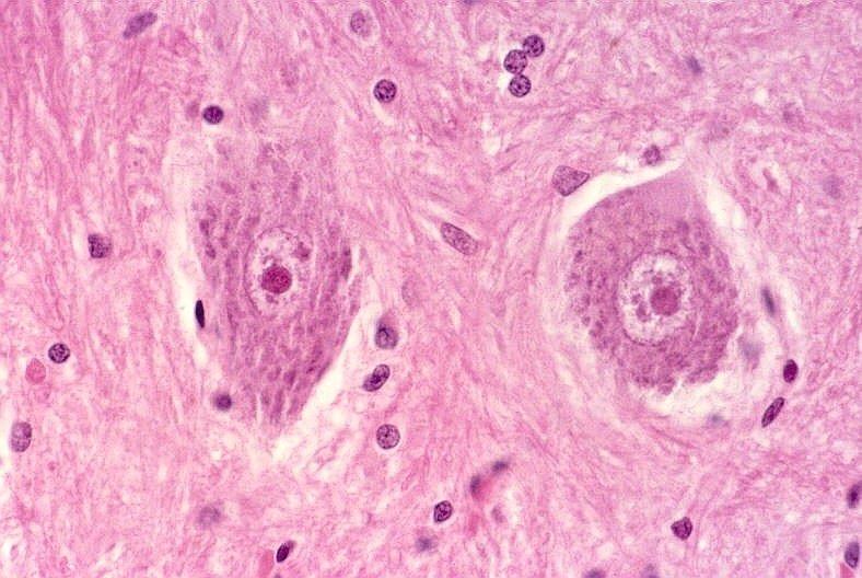 Neurônios motores do corno anterior da medula espinal corados por HE.