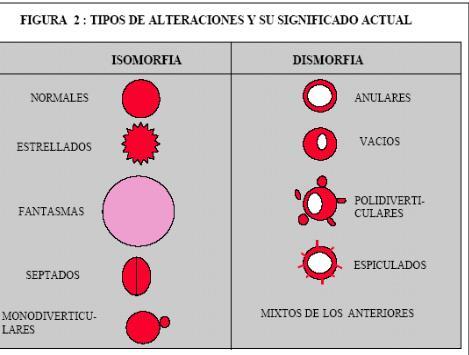 anular B.