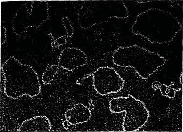 Genetica microbiana bactérias normais dos pacientes (como a E. coli) também demonstraram ser resistentes.