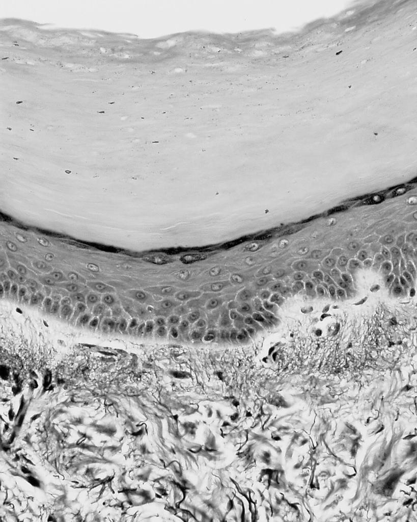 superfície externa irregular (papilas dérmicas) formada por duas camadas : camada papilar e camada reticular.