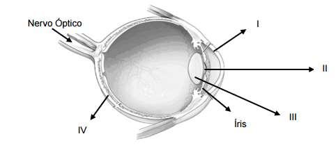 b) Indique os genótipos dos indivíduos afetados e de seus pais. 5. (UEMG) doença ainda muito disseminada em nosso país, tendo como agentes patogênicos o Necator americanus e o Ancylostoma duodenale.