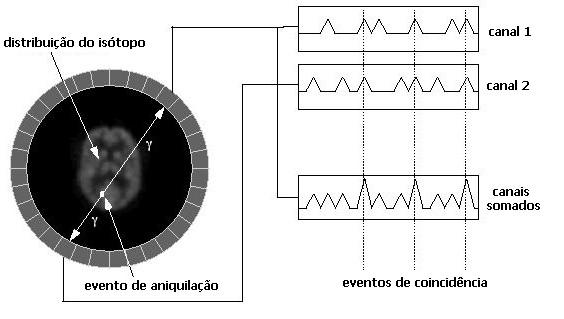 INTRODUÇÃO 22 Na FIG. 22, os líquidos apresentam uma tonalidade hipo-intensa (mais escura) em T1 e hiper-intensa (mais clara) em T2, como se pode notar nos globos oculares.