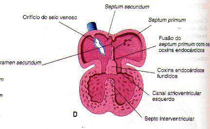 A formação do septo interventricular, mostrada na Figura 5, consiste em membrana espessa com uma borda côncava, no assoalho do ventrículo, perto do seu ápice.