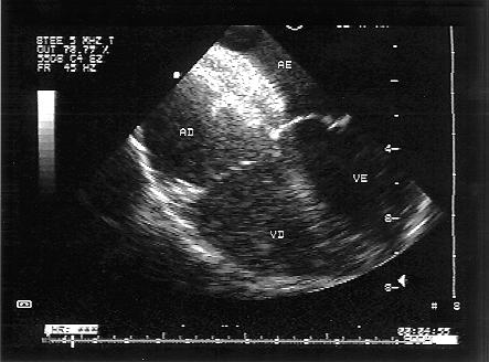 Arq Bras Cardiol Pedra e col (ECG) e ETT.