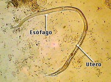 (a) Fêmea parasita (b) Macho de vida livre (c) Fêmea de vida livre - Fêmeas parasitas: são as maiores. O esôfago é filarióide. São triplóides.