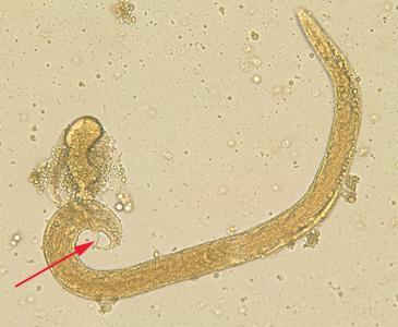 Macho de vida livre com espículo - Larvas: as larvas de ambos os tipos apresentam vestíbulo bucal curto (o que difere dos