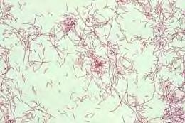 Características do género Legionella Bacilo de Gram negativo, pleomórfico, aeróbio, móvel Ubíquo na água doce ambiente, associado a biofilmes e parasita intracelular de protozoários (amibas e outros)