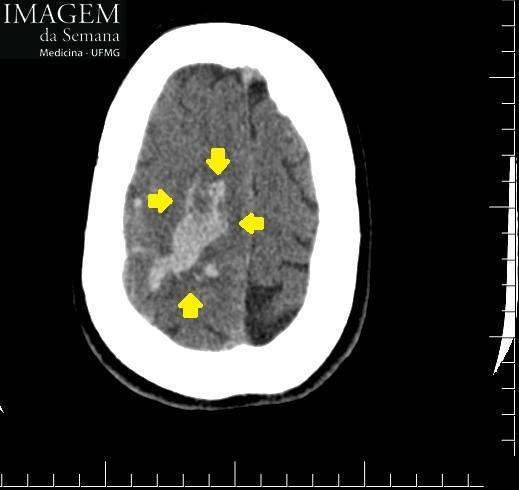 Tomografia computadorizada (TC), Ressonância magnética (RM) Análise da Imagem