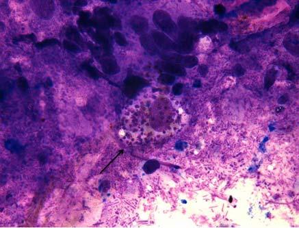 Resultados do hemograma e da bioquímica sérica antes (D0) e depois (D90) do tratamento de um cão com LVC apresentando hematoquezia recorrente e L.