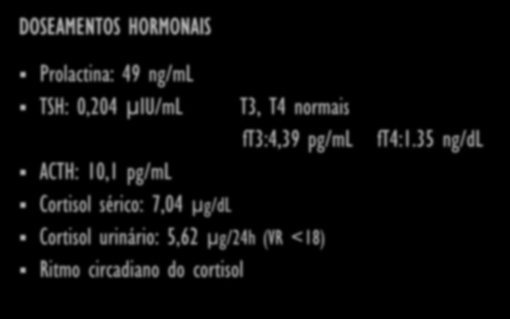 CASO CLÍNICO DOSEAMENTOS HORMONAIS Prolactina: 49 ng/ml TSH: 0,204 μiu/ml ACTH: 10,1 pg/ml Cortisol sérico: 7,04
