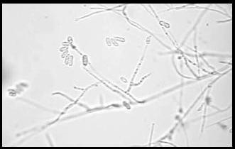fungo; (c) Conidióforos de E. weberi (1000x).