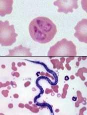 A parasitose por Babesia canis geralmente determina um esfregaço sanguíneo com a presença de anemia regenerativa, apresentando anisocitose e policromasia.