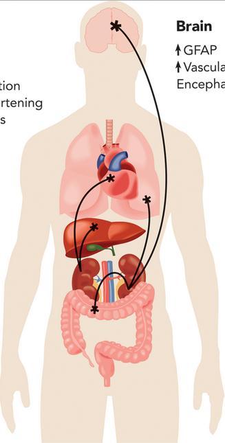 Alterações pulmonares: congestão, SARA, pneumonia bacteriana Insuficiência hepática: dano direto, choque, inflamação.