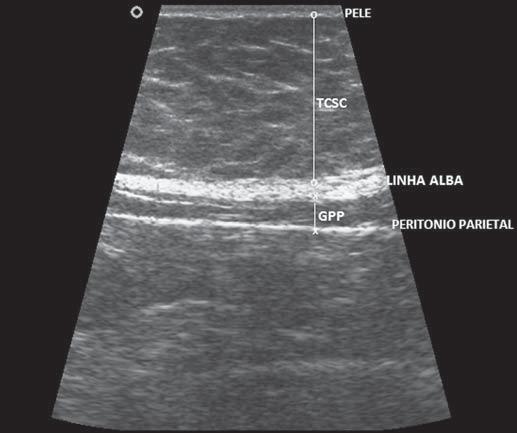 magnética (RM) e a ultrassonografia (US) (6). A TC é o método mais utilizado, mas há exposição à radiação ionizante e tem alto custo.