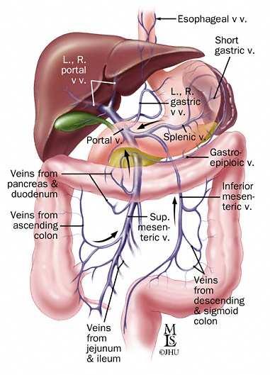 porta > 13 mm Diâmetro das veias mesentérica superior e esplênica >