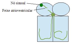 25 FIGURA 25. Bloqueio atrioventricular dificultando e atrasando a condução do impulso elétrico do nó sinusal para o nó atrioventricular.