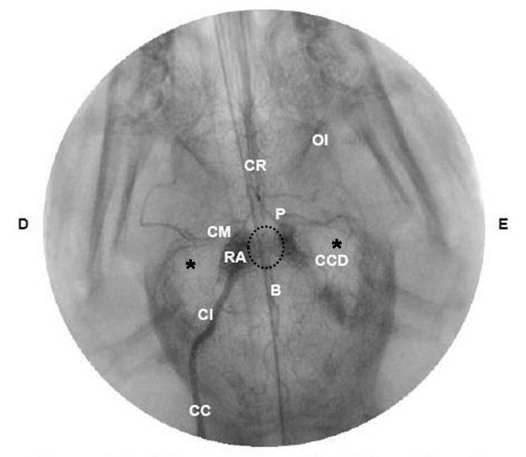 Figura 4 Imagem angiográfica evidenciando a ramificação da artéria carótida comum (CC), artéria carótida interna (CI), rede admirável epidural (RA), círculo