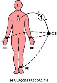 Atividade Elétrica do Coração 10 V1 4º espaço intercostal à direita da borda esternal. V2 4º espaço intercostal à esquerda da borda esternal. V3 posição intermediaria entre V2 e V4.
