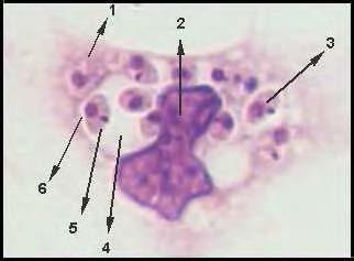 26 Figura 4 Amastigotas em macrófagos de cultura corados por Giemsa. 1) macrófago; 2) Núcleo do macrófago; 3) Amastigota; 4) Fagolisossomo do macrófago; 5) Cinetoplasto; e 4) Núcleo da amastigota.