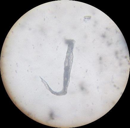 Figura 2: Análise dos materiais estranhos que apresentam risco a saúde humana por meio do Microscópio Óptico. A) mosquito, B) pelo e C) suspeita de membro de artrópode.