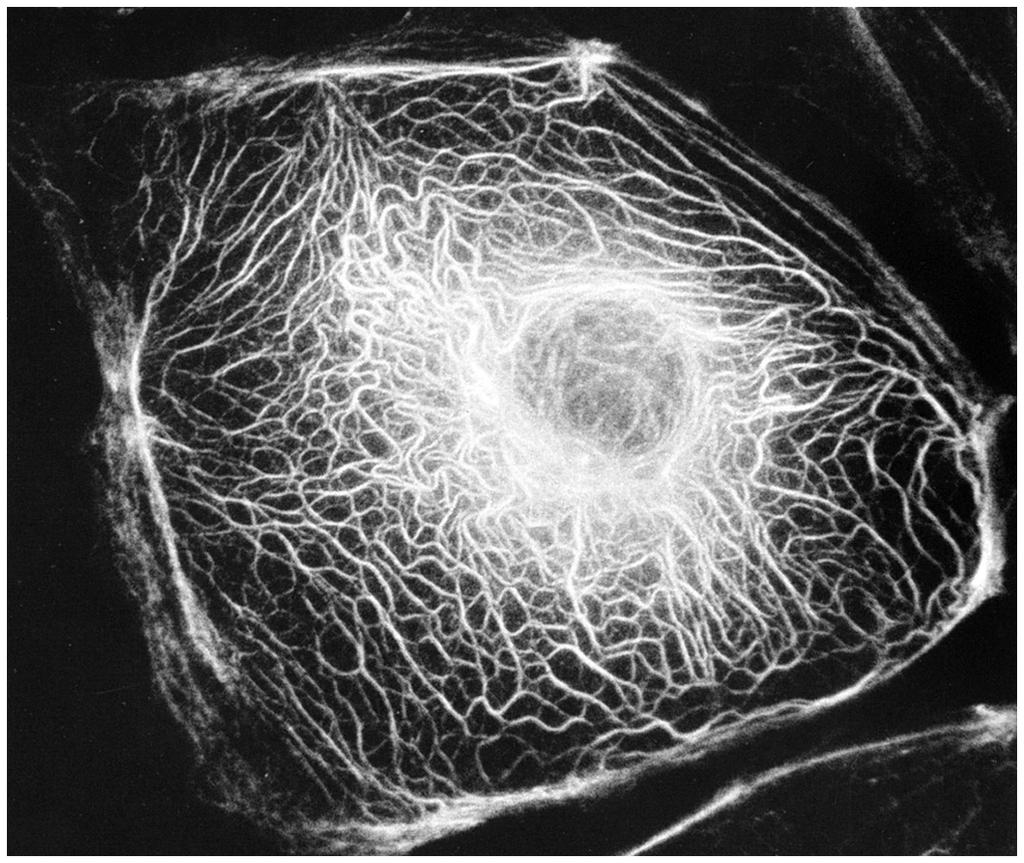 Micrografia de fluorescência de uma célula de fibroblasto
