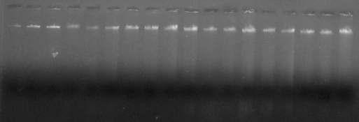 27 1 2 A B C D E F G H I J K L M N O P Figura 1 - Padrão eletroforético da integridade das amostras de DNA. Colunas 1 e 2 correspondem a 100 e 200 ng de DNA λ, respectivamente (marcador).