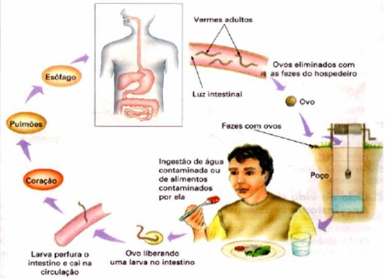 ASCARIDÍASE Crédito da foto: http://materiacfb.blogspot.com.br/2011/06/ciclo-daascaridiase.