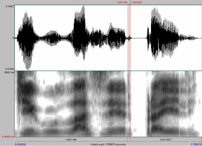 Espectrograma 6- Tap em coda na palavra Expor Nos dois espectrogramas, nota-se a diferenças quanto à qualidade deles.