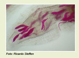 Juvenis de nematóide de galhas (gênero