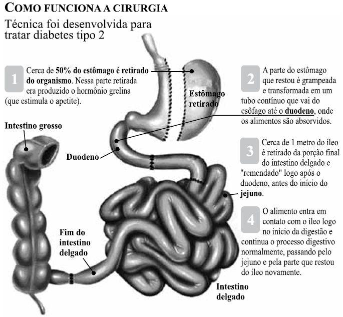 c) se encontrará menos água no organismo dos estudantes em relação ao professor, pois sendo mais jovens andam mais rápido que o professor, e, portanto, transpiram mais e perdem mais água.